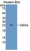 PDCD6 / ALG-2 Antibody - Western blot of PDCD6 / ALG-2 antibody.