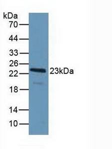 PDCD6 / ALG-2 Antibody - Western Blot; Sample: Human Hela Cells.