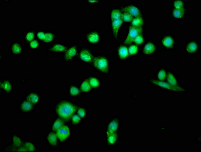 PDCD6 / ALG-2 Antibody - Immunofluorescence staining of PC-3 cells with PDCD6 Antibody at 1:66, counter-stained with DAPI. The cells were fixed in 4% formaldehyde, permeabilized using 0.2% Triton X-100 and blocked in 10% normal Goat Serum. The cells were then incubated with the antibody overnight at 4°C. The secondary antibody was Alexa Fluor 488-congugated AffiniPure Goat Anti-Rabbit IgG(H+L).