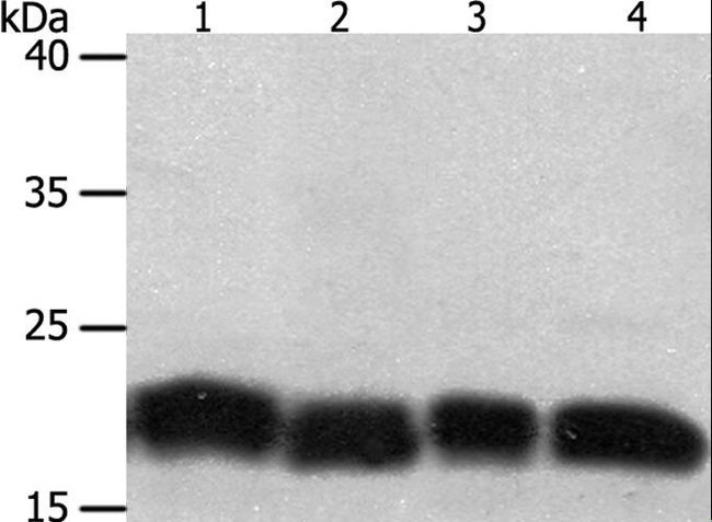 PDCD6 / ALG-2 Antibody - Western blot analysis of Jurkat and HeLa cell, human fetal lung tissue and A549 cell, using PDCD6 Polyclonal Antibody at dilution of 1:200.