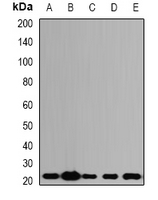 PDCD6 / ALG-2 Antibody - Western blot analysis of ALG-2 expression in SW620 (A); HepG2 (B); mouse kidney (C); mouse lung (D); rat ovary (E) whole cell lysates.