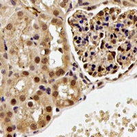 PDCD6 / ALG-2 Antibody - Immunohistochemical analysis of ALG-2 staining in rat kidney formalin fixed paraffin embedded tissue section. The section was pre-treated using heat mediated antigen retrieval with sodium citrate buffer (pH 6.0). The section was then incubated with the antibody at room temperature and detected using an HRP conjugated compact polymer system. DAB was used as the chromogen. The section was then counterstained with hematoxylin and mounted with DPX.