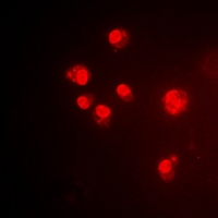 PDCD6 / ALG-2 Antibody - Immunofluorescent analysis of ALG-2 staining in HeLa cells. Formalin-fixed cells were permeabilized with 0.1% Triton X-100 in TBS for 5-10 minutes and blocked with 3% BSA-PBS for 30 minutes at room temperature. Cells were probed with the primary antibody in 3% BSA-PBS and incubated overnight at 4 deg C in a humidified chamber. Cells were washed with PBST and incubated with a DyLight 594-conjugated secondary antibody (red) in PBS at room temperature in the dark.
