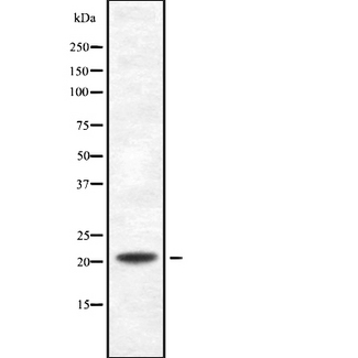 PDCD6 / ALG-2 Antibody - Western blot analysis of PDCD6 using K562 whole lysates.