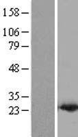 PDCD6 / ALG-2 Protein - Western validation with an anti-DDK antibody * L: Control HEK293 lysate R: Over-expression lysate