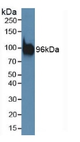 PDCD6IP / ALIX Antibody