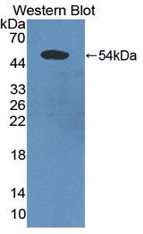 PDCD6IP / ALIX Antibody - Western blot of PDCD6IP / ALIX antibody.