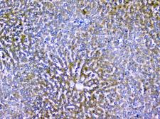 PDCD6IP / ALIX Antibody - IHC analysis of ALIX using anti-ALIX antibody. ALIX was detected in paraffin-embedded section of rat liver tissues. Heat mediated antigen retrieval was performed in citrate buffer (pH6, epitope retrieval solution) for 20 mins. The tissue section was blocked with 10% goat serum. The tissue section was then incubated with 1µg/ml rabbit anti-ALIX Antibody overnight at 4°C. Biotinylated goat anti-rabbit IgG was used as secondary antibody and incubated for 30 minutes at 37°C. The tissue section was developed using Strepavidin-Biotin-Complex (SABC) with DAB as the chromogen.