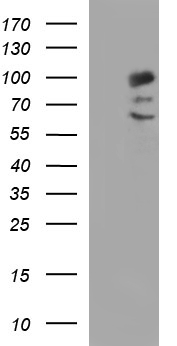 PDCD6IP / ALIX Antibody - HEK293T cells were transfected with the pCMV6-ENTRY control (Left lane) or pCMV6-ENTRY PDCD6IP (Right lane) cDNA for 48 hrs and lysed. Equivalent amounts of cell lysates (5 ug per lane) were separated by SDS-PAGE and immunoblotted with anti-PDCD6IP.