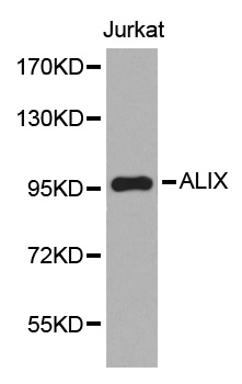 PDCD6IP / ALIX Antibody - Western blot analysis of extracts of Jurkat cells.