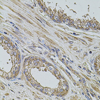 PDCD6IP / ALIX Antibody - Immunohistochemistry of paraffin-embedded human prostate tissue.