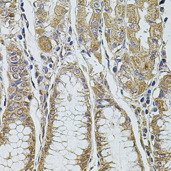 PDCD6IP / ALIX Antibody - Immunohistochemistry of paraffin-embedded human stomach tissue.