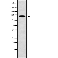 PDCD6IP / ALIX Antibody - Western blot analysis of PDCD6IP using K562 whole cells lysates