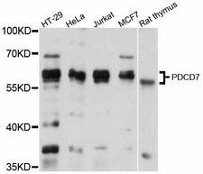 PDCD7 Antibody - Western blot analysis of extracts of various cell lines, using PDCD7 antibody at 1:1000 dilution. The secondary antibody used was an HRP Goat Anti-Rabbit IgG (H+L) at 1:10000 dilution. Lysates were loaded 25ug per lane and 3% nonfat dry milk in TBST was used for blocking. An ECL Kit was used for detection and the exposure time was 10s.