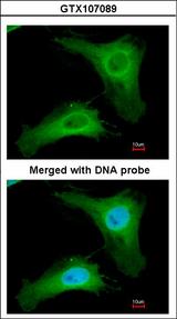 PDCL Antibody - Immunofluorescence of paraformaldehyde-fixed HeLa using PHLP antibody at 1:200 dilution.