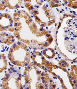PDCL Antibody - Immunohistochemical of paraffin-embedded H.kidney section using PDCL Antibody. Antibody was diluted at 1:25 dilution. A peroxidase-conjugated goat anti-rabbit IgG at 1:400 dilution was used as the secondary antibody, followed by DAB staining.