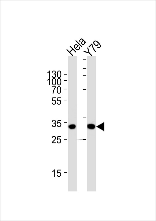 PDCL Antibody - Western blot of lysates from HeLa, Y79 cell line (from left to right) with PDCL Antibody. Antibody was diluted at 1:1000 at each lane. A goat anti-rabbit IgG H&L (HRP) at 1:5000 dilution was used as the secondary antibody. Lysates at 35 ug per lane.