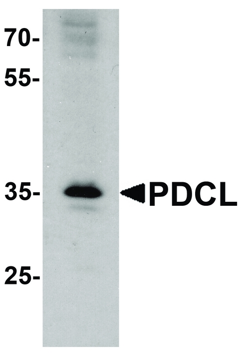 PDCL Antibody - Western blot analysis of PDCL in K562 cell lysate with PDCL antibody at 1 ug/ml.