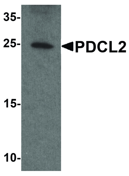 PDCL2 Antibody - Western blot analysis of PDCL2 in rat liver tissue lysate with PDCL2 antibody at 1 ug/ml.