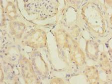 PDCL2 Antibody - Immunohistochemistry of paraffin-embedded human kidney tissue using antibody at dilution of 1:100.