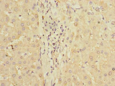 PDCL2 Antibody - Immunohistochemistry of paraffin-embedded human liver tissue using antibody at dilution of 1:100.
