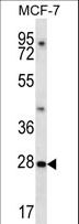 PDCL3 Antibody - PDCL3 Antibody western blot of MCF-7 cell line lysates (35 ug/lane). The PDCL3 antibody detected the PDCL3 protein (arrow).