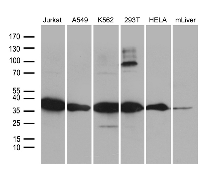 PDCL3 Antibody - Western blot analysis of extracts. (35ug) from 5 different cell lines and mouse liver tissue lysate by using anti-PDCL3 monoclonal antibody. (1:500)