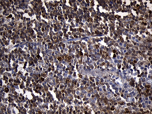 PDCL3 Antibody - Immunohistochemical staining of paraffin-embedded Human tonsil within the normal limits using anti-PDCL3 mouse monoclonal antibody. (Heat-induced epitope retrieval by 1mM EDTA in 10mM Tris buffer. (pH8.5) at 120°C for 3 min. (1:150)