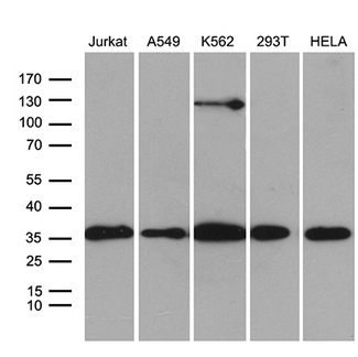 PDCL3 Antibody - Western blot analysis of extracts. (35ug) from 5 different cell lines by using anti-PDCL3 monoclonal antibody. (1:500)