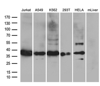PDCL3 Antibody - Western blot analysis of extracts. (35ug) from 5 different cell lines and mouse liver lysate by using anti-PDCL3 monoclonal antibody. (1:500)