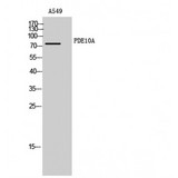 PDE10A Antibody - Western blot of PDE10A antibody