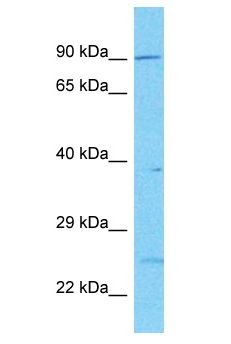 PDE10A Antibody - PDE10A antibody Western Blot of PANC1. Antibody dilution: 1 ug/ml.  This image was taken for the unconjugated form of this product. Other forms have not been tested.