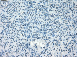 PDE10A Antibody - Immunohistochemical staining of paraffin-embedded endometrium tissue using anti-PDE10A mouse monoclonal antibody. (Dilution 1:50).