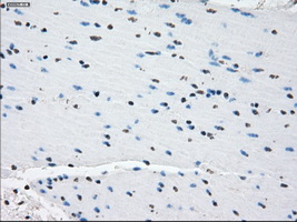 PDE10A Antibody - IHC of paraffin-embedded colon tissue using anti-PDE10A mouse monoclonal antibody. (Dilution 1:50).