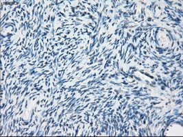 PDE10A Antibody - IHC of paraffin-embedded Ovary tissue using anti-PDE10A mouse monoclonal antibody. (Dilution 1:50).