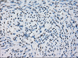 PDE10A Antibody - IHC of paraffin-embedded endometrium tissue using anti-PDE10A mouse monoclonal antibody. (Dilution 1:50).