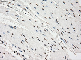 PDE10A Antibody - IHC of paraffin-embedded bladder tissue using anti-PDE10A mouse monoclonal antibody. (Dilution 1:50).