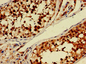 PDE11A Antibody - Immunohistochemistry of paraffin-embedded human testis tissue at dilution of 1:100