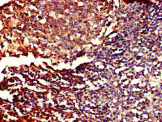 PDE11A Antibody - Immunohistochemistry of paraffin-embedded human tonsil tissue at dilution of 1:100