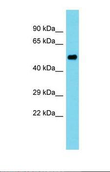 PDE12 Antibody - Western blot of Human Ovary Tumor. PDE12 antibody dilution 1.0 ug/ml.  This image was taken for the unconjugated form of this product. Other forms have not been tested.