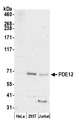 PDE12 Antibody - Detection of human PDE12 by western blot. Samples: Whole cell lysate (50 µg) from HeLa, HEK293T, and Jurkat cells prepared using NETN lysis buffer. Antibody: Affinity purified rabbit anti-PDE12 antibody used for WB at 1:1000. Detection: Chemiluminescence with an exposure time of 3 minutes.