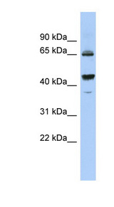 PDE12 Antibody - PDE12 antibody Western blot of OVCAR-3 cell lysate. This image was taken for the unconjugated form of this product. Other forms have not been tested.