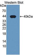 PDE1A Antibody - Western blot of PDE1A antibody.