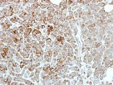PDE1A Antibody - IHC of paraffin-embedded MDAMB468 xenograft using PDE1A antibody at 1:500 dilution.