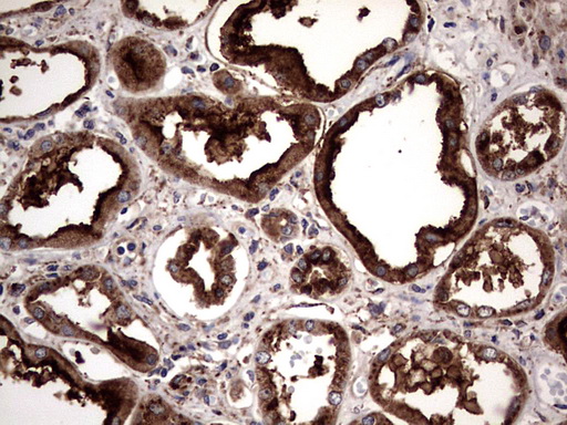 PDE1A Antibody - IHC of paraffin-embedded Human Kidney tissue using anti-PDE1A mouse monoclonal antibody. (Heat-induced epitope retrieval by 1 mM EDTA in 10mM Tris, pH8.5, 120°C for 3min).
