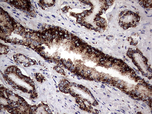 PDE1A Antibody - IHC of paraffin-embedded Human prostate tissue using anti-PDE1A mouse monoclonal antibody. (Heat-induced epitope retrieval by 1 mM EDTA in 10mM Tris, pH8.5, 120°C for 3min).
