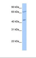 PDE1A Antibody - Jurkat cell lysate. Antibody concentration: 1.0 ug/ml. Gel concentration: 12%.  This image was taken for the unconjugated form of this product. Other forms have not been tested.