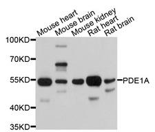 PDE1A Antibody - Western blot analysis of extracts of various cell lines, using PDE1A antibody at 1:1000 dilution. The secondary antibody used was an HRP Goat Anti-Rabbit IgG (H+L) at 1:10000 dilution. Lysates were loaded 25ug per lane and 3% nonfat dry milk in TBST was used for blocking. An ECL Kit was used for detection and the exposure time was 10s.
