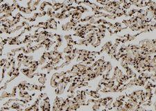 PDE1A Antibody - 1:100 staining human lung tissue by IHC-P. The sample was formaldehyde fixed and a heat mediated antigen retrieval step in citrate buffer was performed. The sample was then blocked and incubated with the antibody for 1.5 hours at 22°C. An HRP conjugated goat anti-rabbit antibody was used as the secondary.
