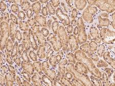 PDE1A Antibody - Immunochemical staining of human PDE1A in human kidney with rabbit polyclonal antibody at 1:100 dilution, formalin-fixed paraffin embedded sections.